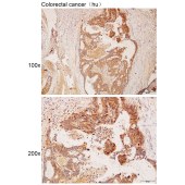 Solarbio K112201P Anti-MYOM2 Polyclonal Antibody