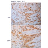 Solarbio K110509P Anti-SRSF4 Polyclonal Antibody
