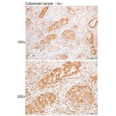 Solarbio K109963P Anti-PHF1 Polyclonal Antibody