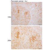 Solarbio K110392P Anti-CCDC14 Polyclonal Antibody