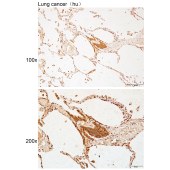 Solarbio K112176P Anti-LMTK3 Polyclonal Antibody