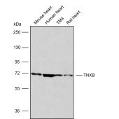 Solarbio K009874P Anti-TNXB Polyclonal Antibody