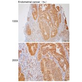 Solarbio K112261P Anti-GLYATL2 Polyclonal Antibody