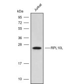 Solarbio K009842P Anti-RPL10L Polyclonal Antibody