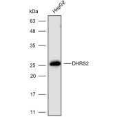 Solarbio K110462P Anti-DHRS2 Polyclonal Antibody