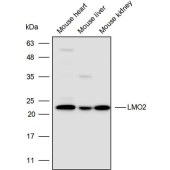 Solarbio K110518P Anti-LMO2 Polyclonal Antibody