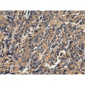 Solarbio K009808P Anti-TRIM26 Polyclonal Antibody