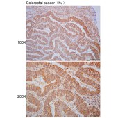 Solarbio K110350P Anti-MRPS11 Polyclonal Antibody