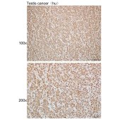 Solarbio K110035P Anti-SPAG8 Polyclonal Antibody
