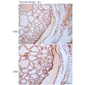 Solarbio K112281P Anti-CHMP5 Polyclonal Antibody