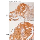 Solarbio K112230P Anti-GBA2 Polyclonal Antibody