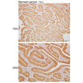 Solarbio K110039P Anti-PGAP4 Polyclonal Antibody