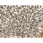 Solarbio K009867P Anti-DNAI2 Polyclonal Antibody