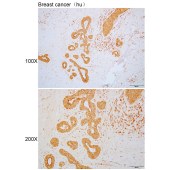 Solarbio K110368P Anti-CCDC106 Polyclonal Antibody