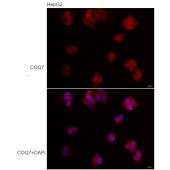 Solarbio K109932P Anti-COQ7 Polyclonal Antibody