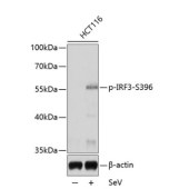 Solarbio K009334P Anti-Phospho-IRF3-S396 Polyclonal Antibody
