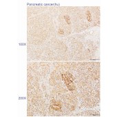 Solarbio K110494P Anti-TBC1D5 Polyclonal Antibody
