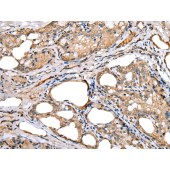 Solarbio K009813P Anti-LRRC19 Polyclonal Antibody