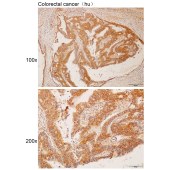 Solarbio K112198P Anti-ZNF608 Polyclonal Antibody