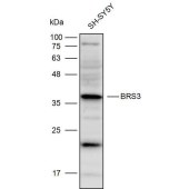 Solarbio K110319P Anti-BRS3 Polyclonal Antibody