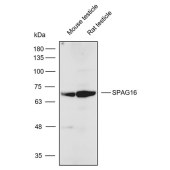 Solarbio K112315P Anti-SPAG16 Polyclonal Antibody