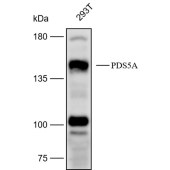 Solarbio K112419P Anti-PDS5A Polyclonal Antibody