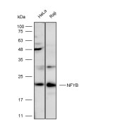 Solarbio K112285P Anti-NFYB Polyclonal Antibody