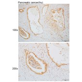 Solarbio K110109P Anti-RNASE11 Polyclonal Antibody