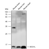 Solarbio K112249P Anti-NDUFA7 Polyclonal Antibody
