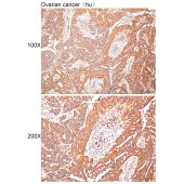 Solarbio K112430P Anti-GRIK2 Polyclonal Antibody