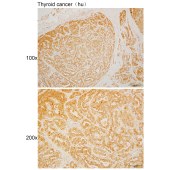 Solarbio K110510P Anti-PFN4 Polyclonal Antibody