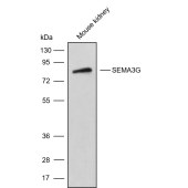 Solarbio K009904P Anti-SEMA3G Polyclonal Antibody