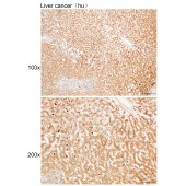Solarbio K109958P Anti-MKNK1 Polyclonal Antibody