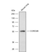 Solarbio K009872P Anti-CORO2B Polyclonal Antibody