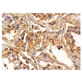 Solarbio K009780M Anti-AF-6（B-5） Monoclonal Antibody