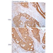 Solarbio K112182P Anti-NCOA-3 Polyclonal Antibody