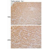 Solarbio K110096P Anti-DHDDS Polyclonal Antibody