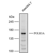 Solarbio K112180P Anti-POLR3A Polyclonal Antibody