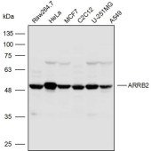 Solarbio K110283P Anti-ARRB2 Polyclonal Antibody