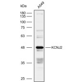 Solarbio K109954P Anti-KCNJ2 Polyclonal Antibody
