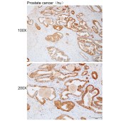Solarbio K112258P Anti-MKRN2 Polyclonal Antibody