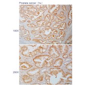 Solarbio K110509P Anti-SRSF4 Polyclonal Antibody