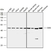 Solarbio K110022P Anti-GSS Polyclonal Antibody
