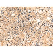 Solarbio K009851P Anti-ZFYVE27 Polyclonal Antibody