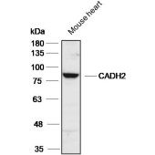 Solarbio K106417P Anti-CADH2 Polyclonal Antibody