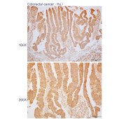 Solarbio K110477P Anti-DDX49 Polyclonal Antibody