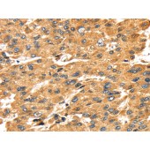 Solarbio K009804P Anti-SH3KBP1 Polyclonal Antibody