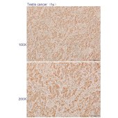 Solarbio K110298P Anti-TNFAIP6 Polyclonal Antibody