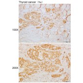 Solarbio K110108P Anti-EXOSC1 Polyclonal Antibody