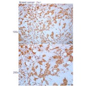 Solarbio K112286P Anti-PSMB7 Polyclonal Antibody